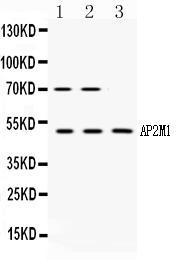 Anti-AP2M1 Rabbit Polyclonal Antibody