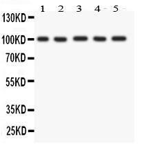 Anti-FGFR4 Polyclonal Antibody