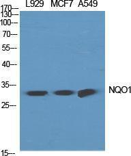 Western blot analysis of various cells using Anti-NQO1 Antibody