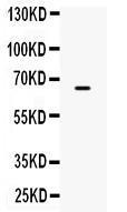 Anti-ST7 Rabbit Polyclonal Antibody