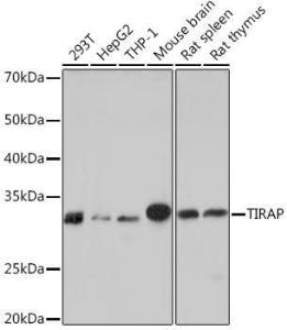 Western blot analysis of extracts of various cell lines, using Anti-TIRAP Antibody [ARC1686] (A307048) at 1:1000 dilution. The secondary Antibody was Goat Anti-Rabbit IgG H&L Antibody (HRP) at 1:10000 dilution. Lysates/proteins were present at 25 µg per lane