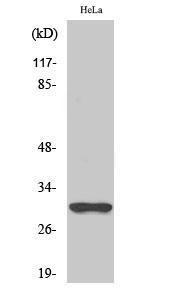 Western blot analysis of Jurkat cells using Anti-NQO1 Antibody