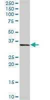 Anti-CEBPE Rabbit Polyclonal Antibody