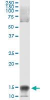 Anti-NFATC2IP Mouse Monoclonal Antibody [clone: 3E9-B7]