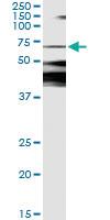 Anti-CAMK2B Antibody Pair