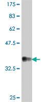 Anti-NDUFV1 Mouse Polyclonal Antibody