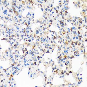 Immunohistochemistry analysis of paraffin-embedded rat lung using Anti-TIRAP Antibody [ARC1686] (A307048) at a dilution of 1:100 (40X lens). Perform microwave antigen retrieval with 10 mM Tris/EDTA buffer pH 9.0 before commencing with IHC staining protocol