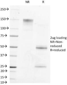 SDS-PAGE analysis of Anti-alpha Fetoprotein Antibody [MBS-12] under non-reduced and reduced conditions; showing intact IgG and intact heavy and light chains, respectively. SDS-PAGE analysis confirms the integrity and purity of the antibody