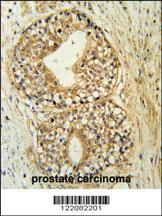 Anti-ATP11C Rabbit Polyclonal Antibody