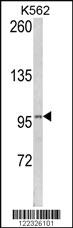 Anti-LPIN2 Rabbit Polyclonal Antibody