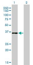 Anti-CEBPE Mouse Monoclonal Antibody [clone: 7A4]