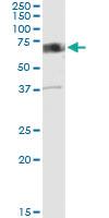 Anti-CAMK2B Polyclonal Antibody Pair