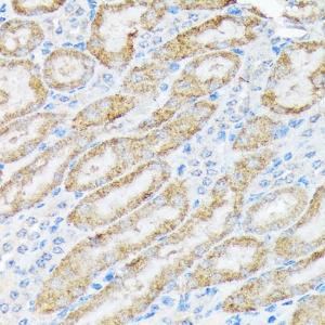 Immunohistochemistry analysis of paraffin-embedded mouse kidney using Anti-TIRAP Antibody [ARC1686] (A307048) at a dilution of 1:100 (40X lens). Perform microwave antigen retrieval with 10 mM Tris/EDTA buffer pH 9.0 before commencing with IHC staining protocol