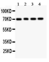 Anti-FOXO1A Polyclonal Antibody