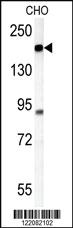 Anti-ATP11C Rabbit Polyclonal Antibody