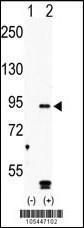 Anti-MARK4 Rabbit Polyclonal Antibody (Biotin)