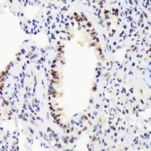 Immunohistochemistry analysis of paraffin-embedded rat lung using Anti-EWSR1 / EWS Antibody [ARC1674] (A307049) at a dilution of 1:100 (40x lens). Perform microwave antigen retrieval with 10 mM Tris/EDTA buffer pH 9.0 before commencing with IHC staining protocol.