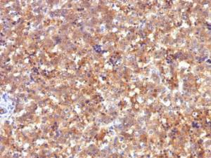 Immunohistochemical analysis of formalin-fixed, paraffin-embedded human fetal liver using Anti-alpha Fetoprotein Antibody [C2]