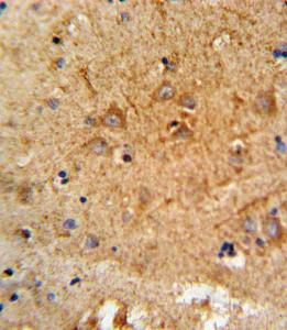 Anti-Proprotein Convertase 2 Rabbit Polyclonal Antibody