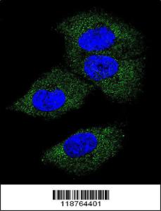 Anti-Macrophage Colony Stimulating Factor Rabbit Polyclonal Antibody