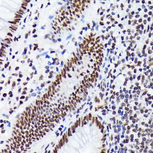 Immunohistochemistry analysis of paraffin-embedded human appendix tissue using Anti-EWSR1 / EWS Antibody [ARC1674] (A307049) at a dilution of 1:100 (40x lens). Perform microwave antigen retrieval with 10 mM Tris/EDTA buffer pH 9.0 before commencing with IHC staining protocol.