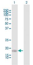 Anti-CEBPG Rabbit Polyclonal Antibody