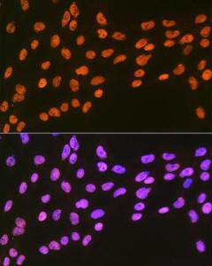 Immunofluorescence analysis of C6 cells using Anti-EWSR1 / EWS Antibody [ARC1674] (A307049) at a dilution of 1:100 (40x lens). DAPI was used to stain the cell nuclei (blue).