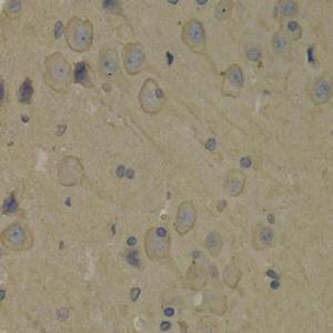 Immunohistochemistry analysis of paraffin-embedded rat brain using Anti-PI 3 Kinase p85 alpha Antibody (A12507) at a dilution of 1:100 (40X lens). Perform microwave antigen retrieval with 10 mM PBS buffer pH 7.2 before commencing with IHC staining protocol