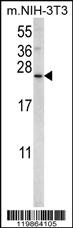 Anti-SNX24 Rabbit Polyclonal Antibody