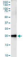 Anti-CEBPG Rabbit Polyclonal Antibody