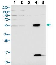 Anti-UFSP2 Rabbit Polyclonal Antibody