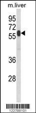 Anti-HACL1 Rabbit Polyclonal Antibody (PE (Phycoerythrin))