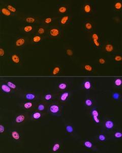 Immunofluorescence analysis of NIH-3T3 cells using Anti-EWSR1 / EWS Antibody [ARC1674] (A307049) at a dilution of 1:100 (40x lens). DAPI was used to stain the cell nuclei (blue).