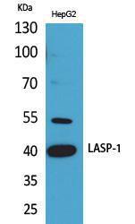 Western blot analysis of HepG2 cells using Anti-LASP1 Antibody