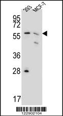 Anti-PGD Rabbit Polyclonal Antibody