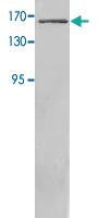 Anti-ACE Rabbit Polyclonal Antibody