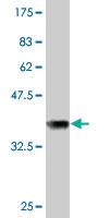 Anti-NDUFV1 Mouse Monoclonal Antibody [clone: 4A7]