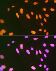 Immunofluorescence analysis of U-2 OS cells using Anti-EWSR1 / EWS Antibody [ARC1674] (A307049) at a dilution of 1:100 (40x lens). DAPI was used to stain the cell nuclei (blue).