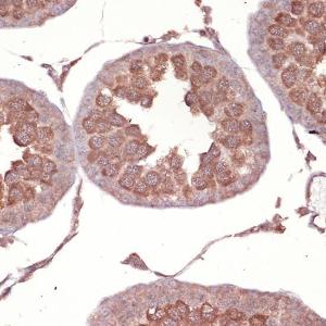 Immunohistochemistry analysis of paraffin-embedded rat testis using Anti-Nck Antibody [ARC1441] (A308147) at a dilution of 1:100 (40x lens) Perform microwave antigen retrieval with 10 mM Tris/EDTA buffer pH 90 before commencing with IHC staining protocol