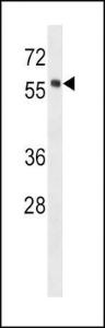 Anti-HCK Rabbit Polyclonal Antibody (AP (Alkaline Phosphatase))