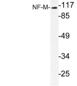 Western blot analysis of lysate from MCF 7cells using Anti-NF-M Antibody