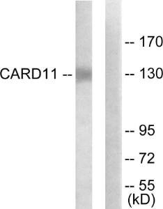 Western blot analysis of lysates from COLO205 cells using Anti-CARD11 Antibody. The right hand lane represents a negative control, where the antibody is blocked by the immunising peptide