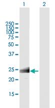 Anti-MS4A12 Mouse Polyclonal Antibody