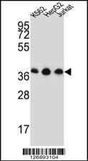 Anti-HNRNPDL Rabbit Polyclonal Antibody