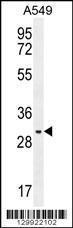 Anti-PABPN1L Rabbit Polyclonal Antibody (FITC (Fluorescein Isothiocyanate))