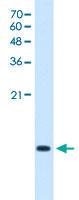 Anti-C3orf10 Rabbit Polyclonal Antibody