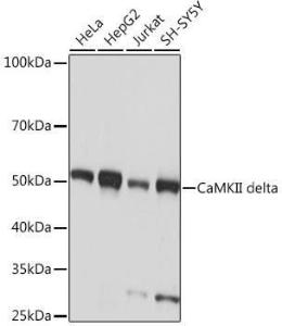 Western blot analysis of extracts of various cell lines, using Anti-CaMKII delta Antibody [ARC1473] (A307051) at 1:1000 dilution