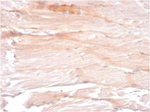 Immunohistochemical analysis of formalin-fixed, paraffin-embedded human skeletal muscle using Anti-Dystrophin Antibody [DMD/3241]