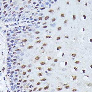 Immunohistochemistry analysis of paraffin-embedded human esophagus using Anti-WDR46 Antibody (A305665) at a dilution of 1:100 (40x lens). Perform high pressure antigen retrieval with 10 mM citrate buffer pH 6.0 before commencing with IHC staining protocol