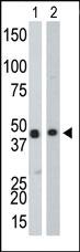 Anti-CKB Rabbit Polyclonal Antibody